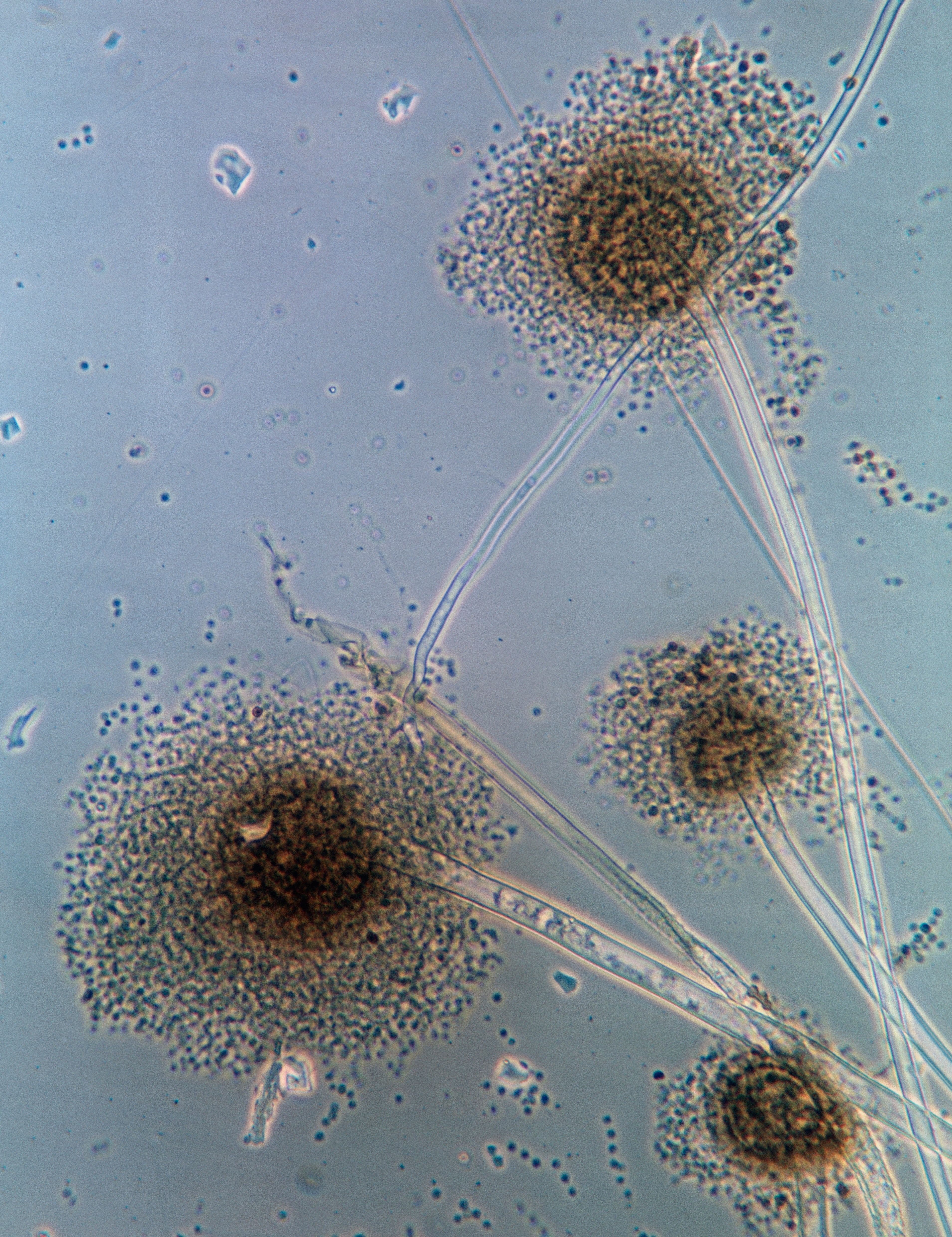 Fungal infection at a Sydney hospital kills two patients